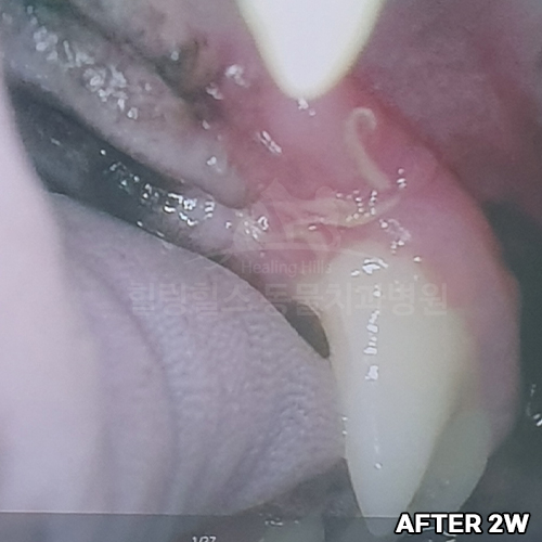 샘플