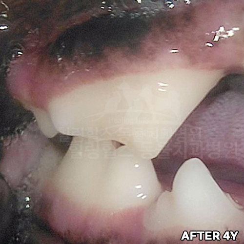 샘플