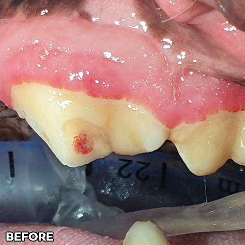 샘플